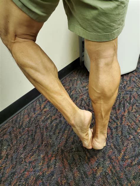 asian calves genetics|asian calf muscles.